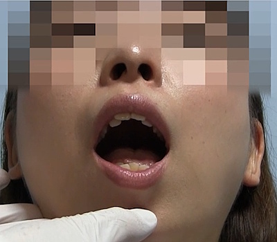 口内を観察される実験体女性
